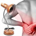 Cách sử dụng đèn hồng ngoại trong điều trị bệnh đau lưng